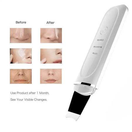 Global Fashion Ultrasonic Skin Cleaner – Deep Cleansing | C-103 Ultrasonic Skin Cleaner Close View Facial Device | جهاز تنظيف البشرة
Global Fashion Ultrasonic Skin Cleaner – Deep Cleansing | C-103 Face Scrubber Detailed View Deep Cleansing | جهاز تقشير البشرة