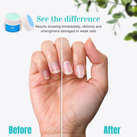 Cuticle Cream 5g – Nourishing Nail Care | Pomegranate Cuticle Cream Close View Nail Care | كريم الكيوتكل
Cuticle Cream 5g – Nourishing Nail Care | Pomegranate Nail Cream Detailed View Moisturizing Treatment | كريم الاظافر